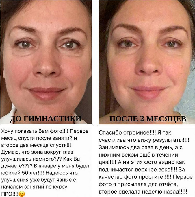 Анастасия Бурдюг Фото До И После
